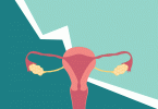 5 signs you might have endometriosis