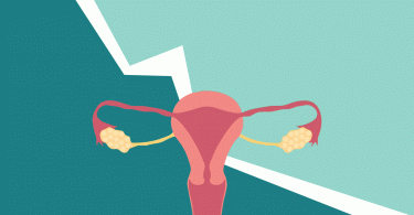 5 signs you might have endometriosis